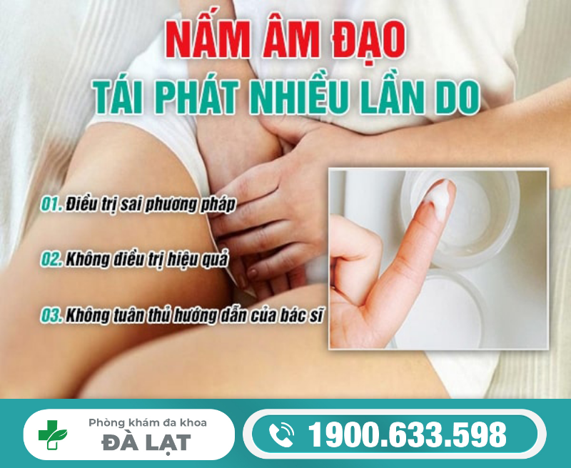 Hình ảnh minh họa